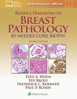 Front cover_Rosen's Diagnosis Of Breast Pathology By Needle Core Biopsy