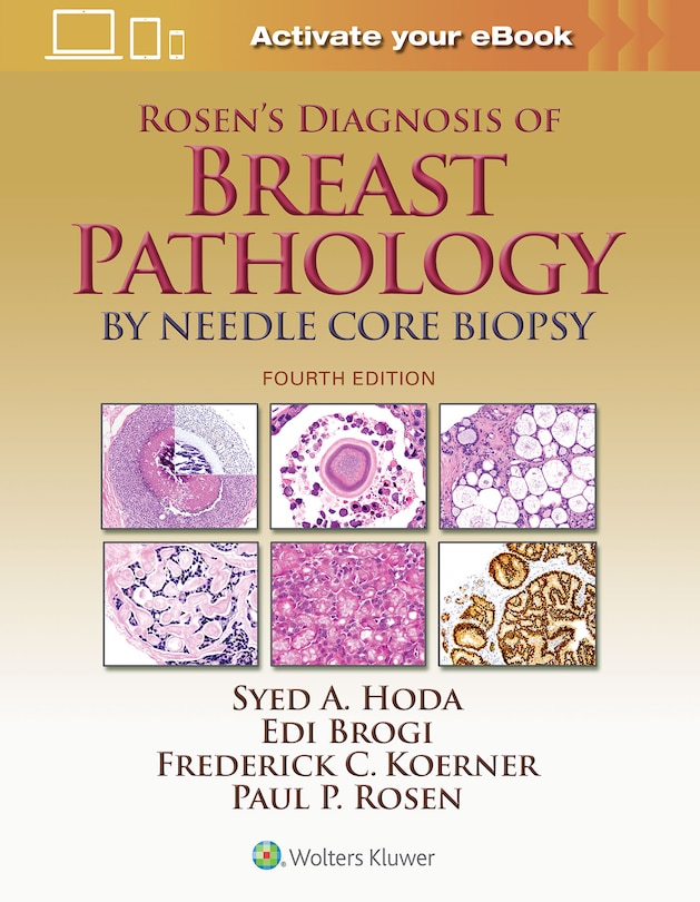 Front cover_Rosen's Diagnosis Of Breast Pathology By Needle Core Biopsy