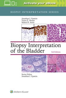 Couverture_Biopsy Interpretation Of The Bladder