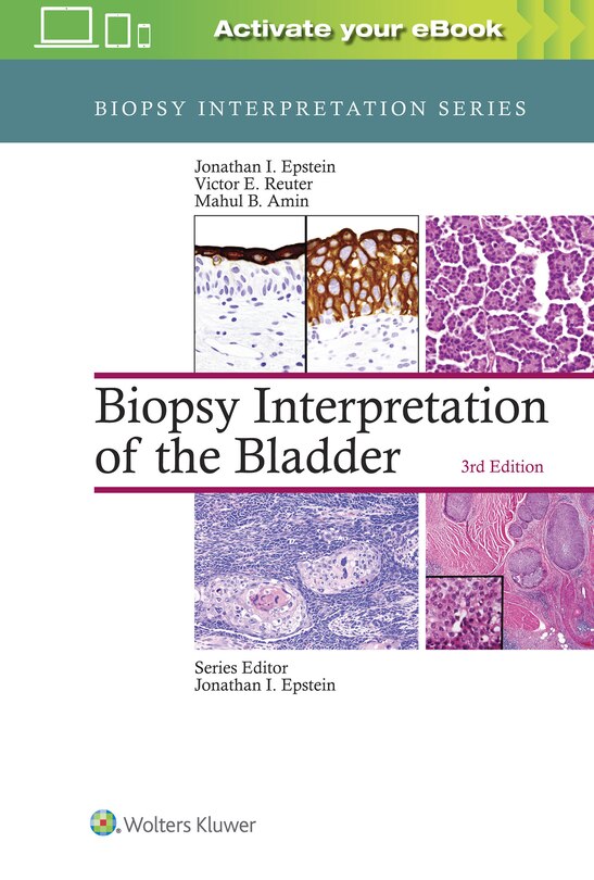 Couverture_Biopsy Interpretation Of The Bladder