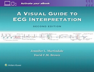 Front cover_A Visual Guide to ECG Interpretation
