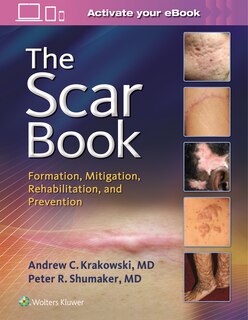 Front cover_Scar Book