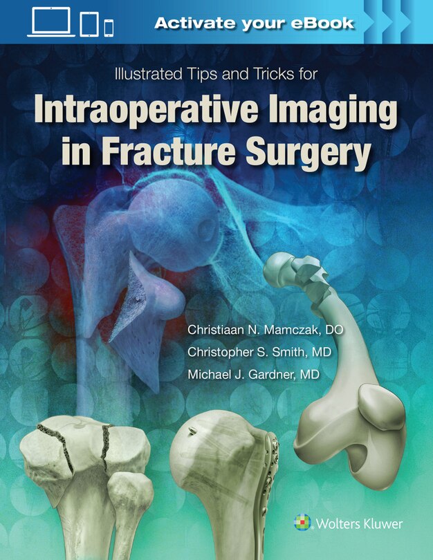 Front cover_Illustrated Tips and Tricks for Intraoperative Imaging in Fracture Surgery