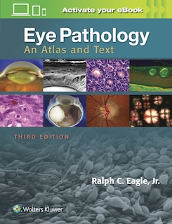 Couverture_Eye Pathology
