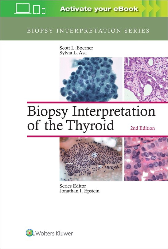 Couverture_Biopsy Interpretation Of The Thyroid