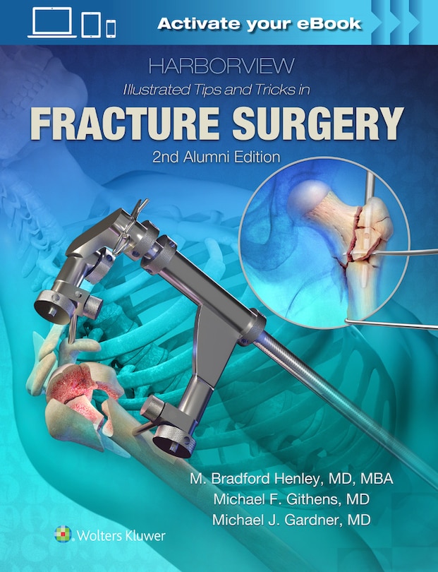 Front cover_Harborview Illustrated Tips And Tricks In Fracture Surgery