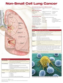 Couverture_Non-small Cell Lung Cancer