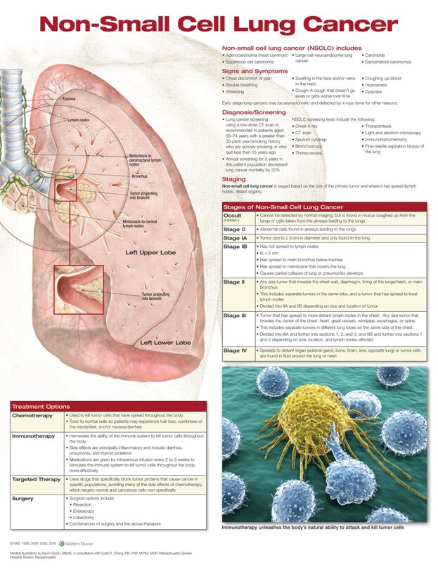 Couverture_Non-small Cell Lung Cancer