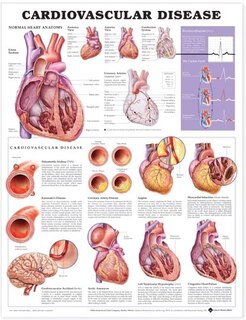 Front cover_Cardiovascular Disease Anatomical Chart
