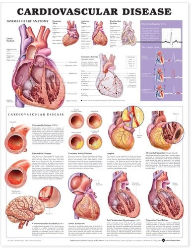Front cover_Cardiovascular Disease Anatomical Chart