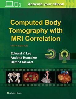 Front cover_Computed Body Tomography With Mri Correlation