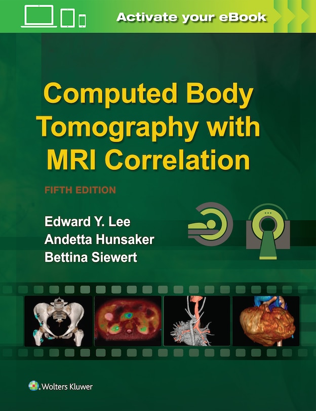 Front cover_Computed Body Tomography With Mri Correlation