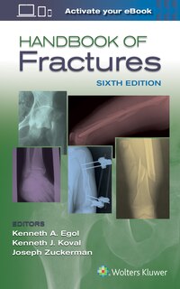 Front cover_Handbook Of Fractures