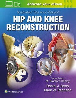 Front cover_Illustrated Tips And Tricks In Hip And Knee Reconstructive And Replacement Surgery