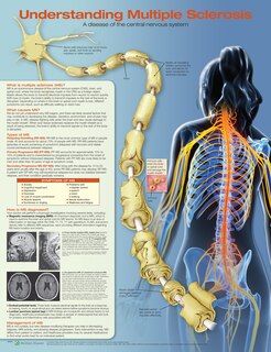 Couverture_Understanding Multiple Sclerosis Anatomical Chart