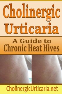 Cholinergic Urticaria: A Guide To Chronic Heat Hives
