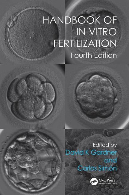 Front cover_Handbook Of In Vitro Fertilization
