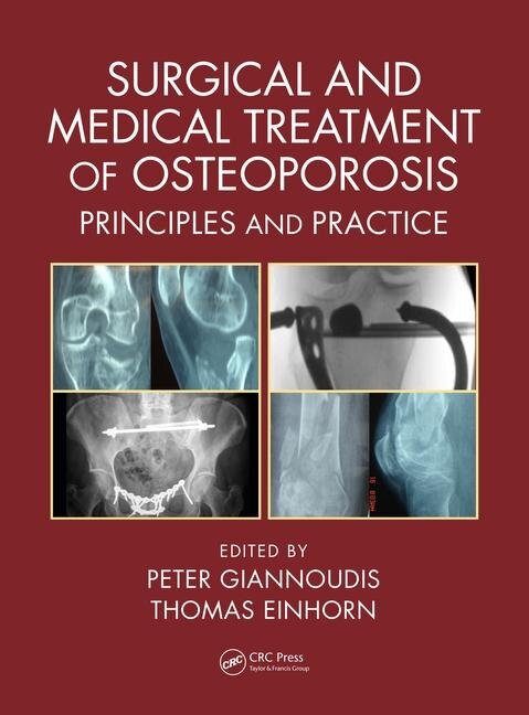 Couverture_Surgical And Medical Treatment Of Osteoporosis