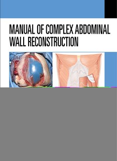 Front cover_Manual Of Complex Abdominal Wall Reconstruction