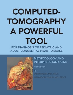 Couverture_Computed-Tomography a Powerful Tool for Diagnosis of Pediatric and Adult Congenital Heart Disease