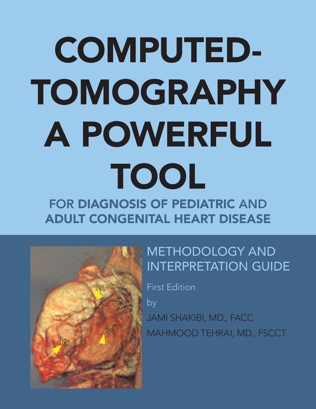 Couverture_Computed-Tomography a Powerful Tool for Diagnosis of Pediatric and Adult Congenital Heart Disease