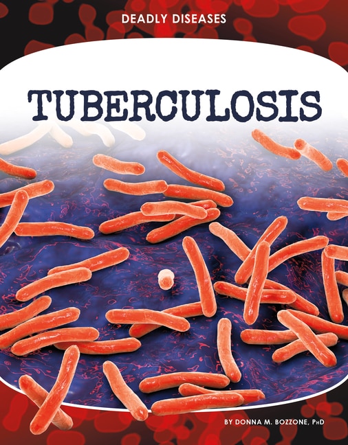 Tuberculosis