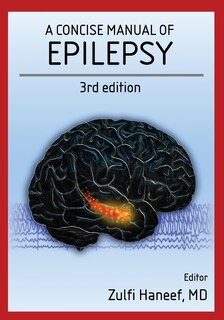 Couverture_A concise manual of epilepsy