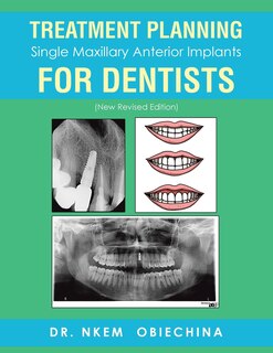 Couverture_Treatment Planning Single Maxillary Anterior Implants for Dentists