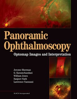 Couverture_Panoramic Ophthalmoscopy