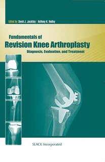 Front cover_Fundamentals of Revision Knee Arthroplasty