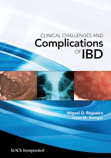 Front cover_Clinical Challenges and Complications of Ibd