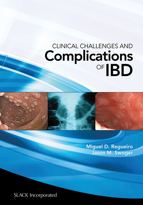 Front cover_Clinical Challenges and Complications of Ibd