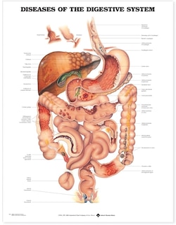 Front cover_Diseases of the Digestive System Anatomical Chart