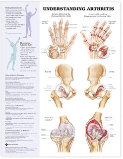 Front cover_Understanding Arthritis Anatomical Chart