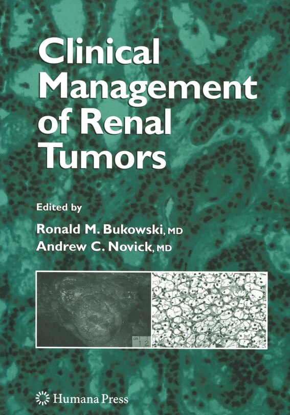 Front cover_Clinical Management of Renal Tumors