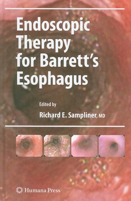 Front cover_Endoscopic Therapy for Barrett's Esophagus