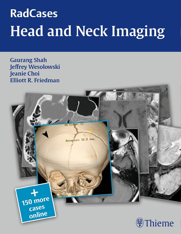 Front cover_Radcases Head And Neck Imaging