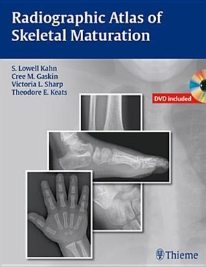 Front cover_Radiographic Atlas of Skeletal Maturation