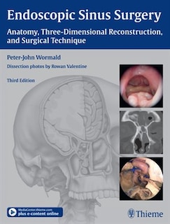 Couverture_Endoscopic Sinus Surgery