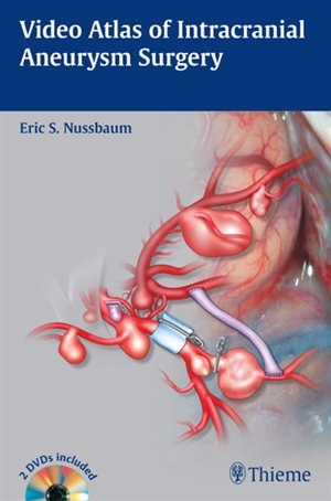 Front cover_Video Atlas Of Intracranial Aneurysm Surgery