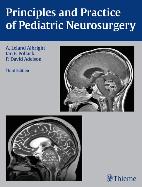 Couverture_Principles And Practice Of Pediatric Neurosurgery
