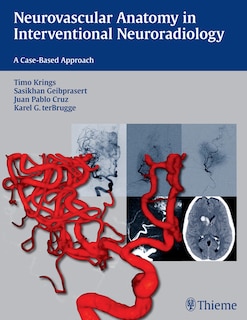 Couverture_Neurovascular Anatomy In Interventional Neuroradiology