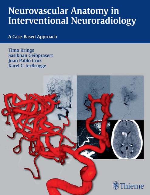 Couverture_Neurovascular Anatomy In Interventional Neuroradiology