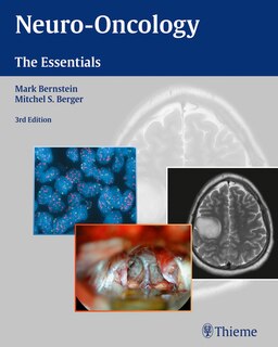 Front cover_Neuro-oncology