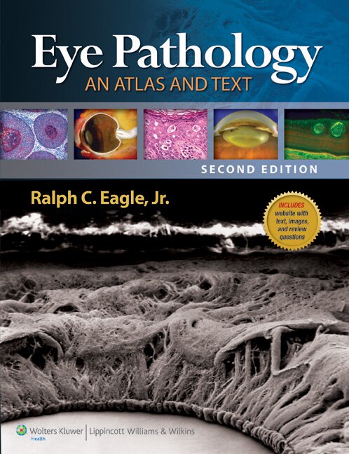Front cover_Eye Pathology