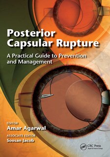 Front cover_Posterior Capsular Rupture