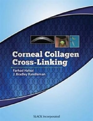 Couverture_Corneal Collagen Cross Linking