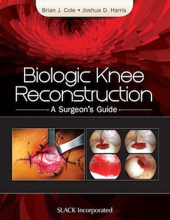 Front cover_Biologic Knee Reconstruction