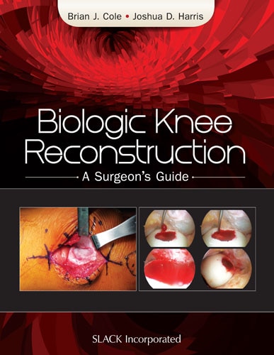 Front cover_Biologic Knee Reconstruction