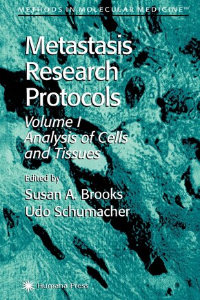 Metastasis Research Protocols